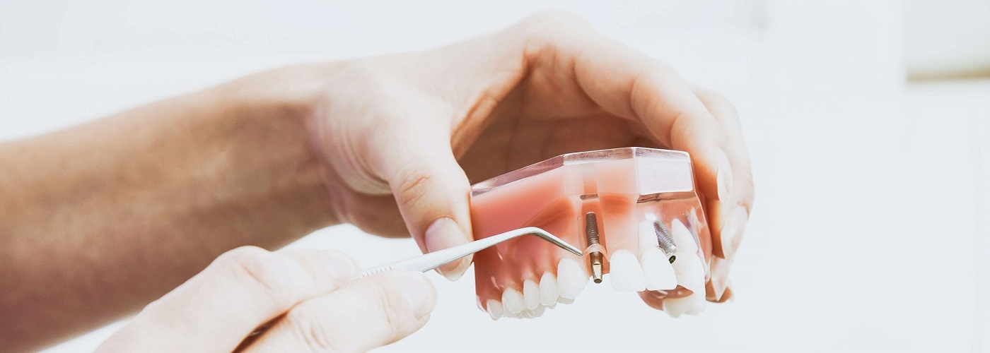 Barska oprema | Zubni implanti Beograd